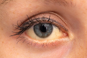 An extreme closeup view on the blue eye of a young Caucasian woman. The whites of the eye are...