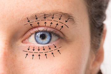 A macro view on the pretty blue eye of a Caucasian girl in her 30s. Arrows point in the direction...