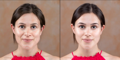 Woman before and after a rejuvenation treatment, from the appearance of a lady to the appearance of...