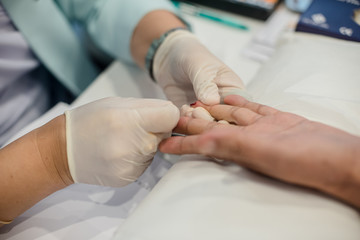 Blood collection staff are using a needle to penetrate the fingertip to check blood sugar levels.