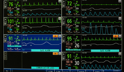 Modern vital signs monitor display at ICU in hospital.