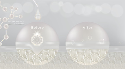 Hyaluronic acid before and after skin solutions ad, white collagen serum drop with cosmetic advertising background ready to use, illustration vector.	