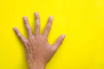 Back left hand on yellow background