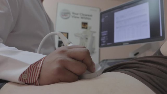 Doctors hands operate an ultrasound machine on patient