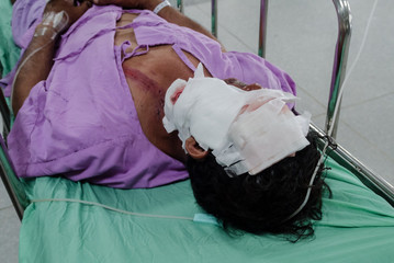 Patients with severe wound on face.