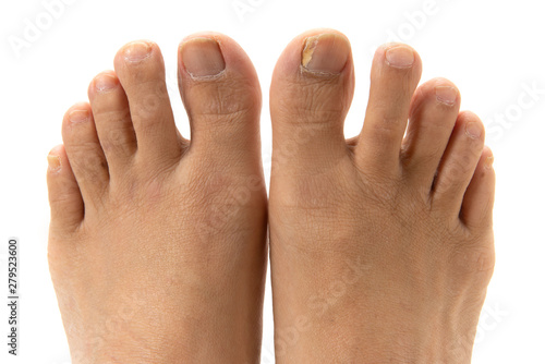 爪水虫 Wall Mural Wallpaper Murals Wallsheaven Caito