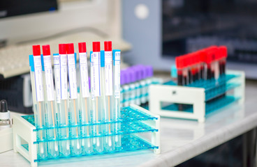 Sterile test swap tubes for taking sample of throat diseases
