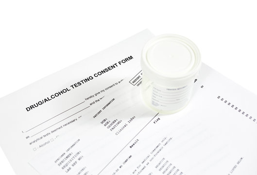 Drug and alcohol testing consent form with sterile urine container and lab report