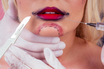 portrait young blonde sexy woman with line arrows on face over studio background. neck lifting and...
