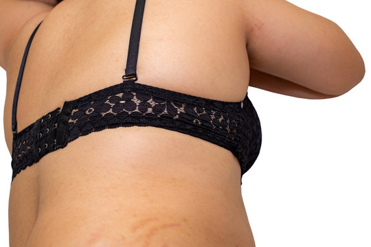 Close up rear view of fat woman lie down on white background, Fat, Stretch marks