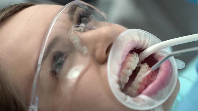Pretty woman's teeth cleaning in dental clinic