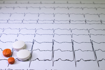 Electrocardiogram with Brugada syndrome. Colored pills on an EKG path. Sudden cardiac death due to...