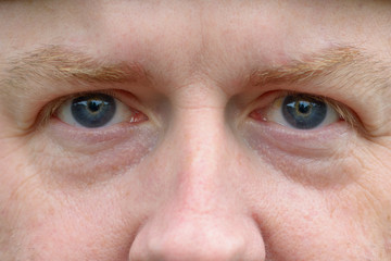 Close up on the blue eyes of a redheaded man