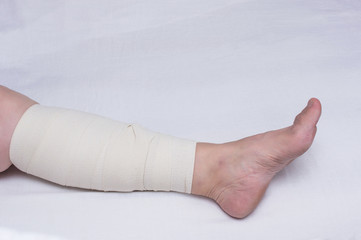 Leg of an elderly woman bandaged with an elastic bandage against varicose veins on the leg,...