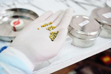 stones from a dog's bladder close-up on the hand of a surgeon doctor vet