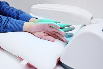 hands of a patient with psoriasis close-up under an ultraviolet lamp. Light therapy, phototherapy - obrazy, fototapety, plakaty