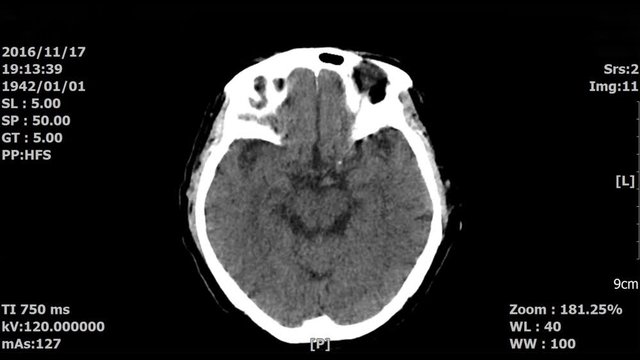 brain scan image by mri or ct scan. radiology concept.