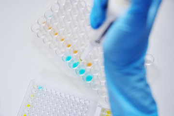 A scientist in a medical laboratory with a dispenser in his hands is doing an analysis
