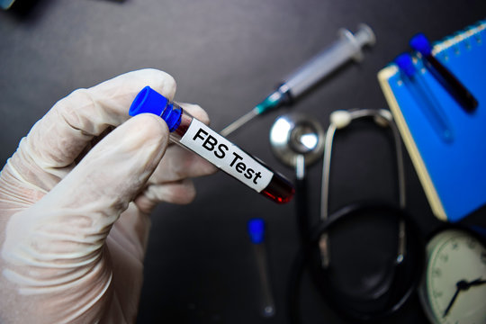 FBS Test text with blood sample. Top view isolated on black background. Healthcare/Medical concept