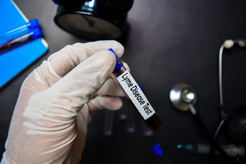 Lyme Disease Test text with blood sample. Top view isolated on black background. Healthcare/Medical concept