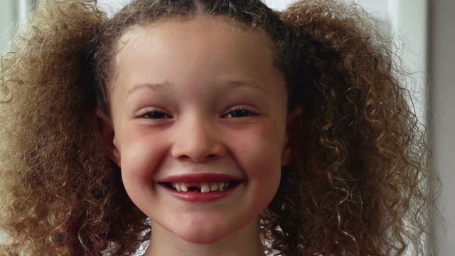 Little girl smiling with missing teeth.