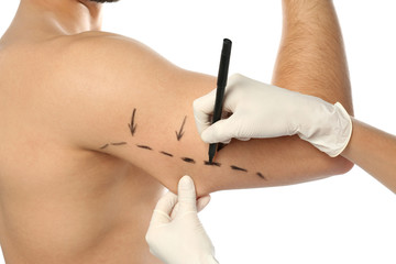 Doctor drawing marks on man's arm for cosmetic surgery operation against white background, closeup