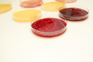 Escherichia coli (E. coli) culture in petri dish with macconkey agar. Bacterium culture growth in glassware. Medical tests in laboratory.