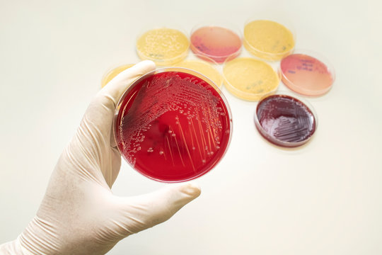 Hand Holding Petri Dish With Escherichia Coli (E. Coli) Culture In Macconkey Agar. Bacterium Culture Growth In Glassware. Medical Tests In Laboratory.