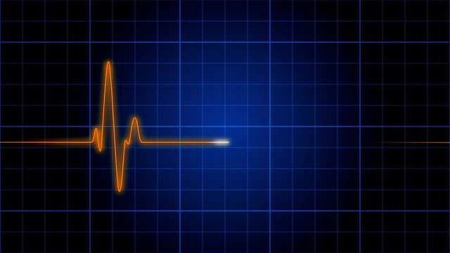 An electrocardiogram heart monitor pulses on a blue grid (Loop).