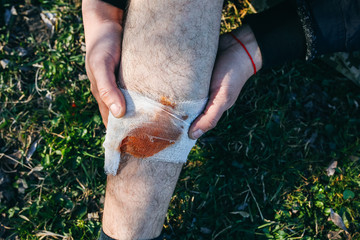 Man is putting bandage on bleeding wound. Injured leg. Tourist in the nature. Infection danger....