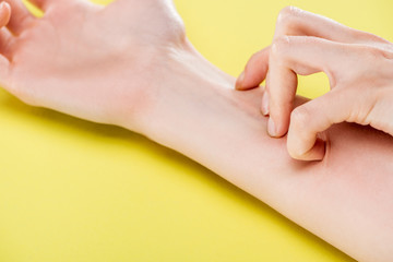 cropped view of woman itching hand on yellow background