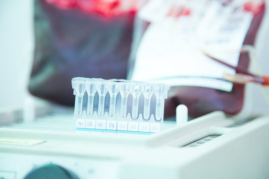 Laboratory testing.compatibility between donor blood and patient blood. crossmatch ,gel method.