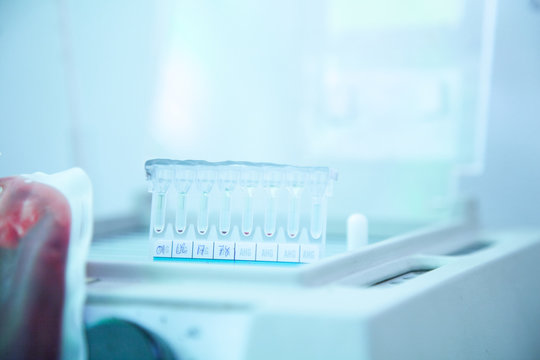 Laboratory testing.compatibility between donor blood and patient blood. crossmatch ,gel method.
