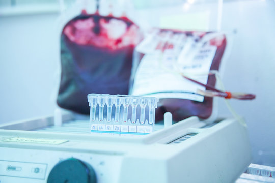 Laboratory testing.compatibility between donor blood and patient blood. crossmatch ,gel method.
