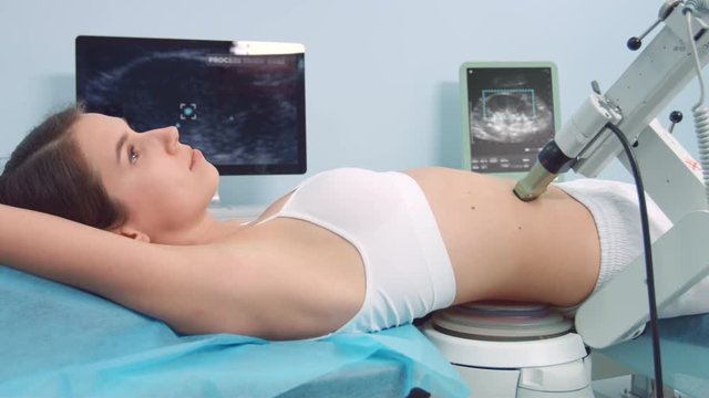 Extracorporeal Shockwave Lithotripsy - Kidney Stones Treatment