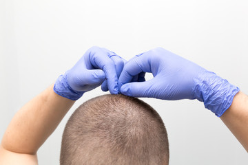 Checking hair for head lice
