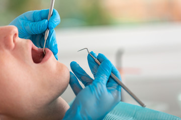 A female dentist examines the oral cavity of the patient with a tool with a mirror. Close-up...
