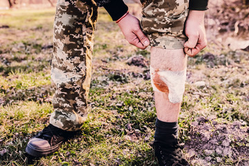 Man is putting bandage on bleeding wound. Injured leg. Tourist in the nature. Infection danger. Medical treatment. Hiking trauma.