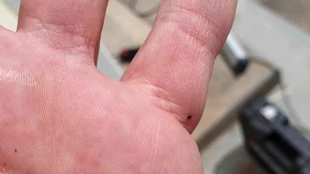 Tick crawling on human skin to find a good place to suck blood