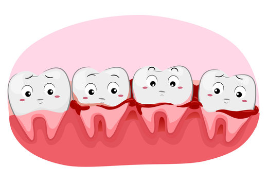 Teeth Mascot Bleeding Gums Illustration