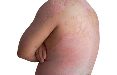 Men crossing arms turned aside with full wound