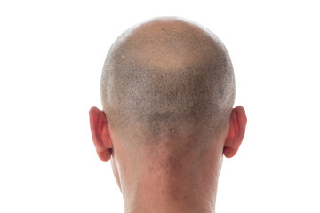 Bald man head on the back