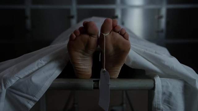 Body on a Gurney in the morgue
