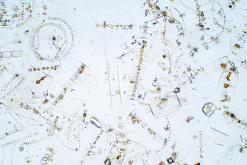 Marine aquatic plankton under microscope view.