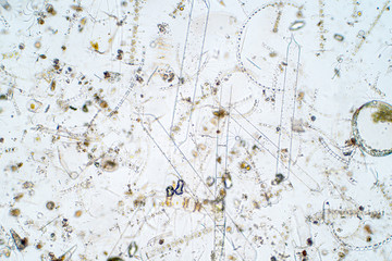 Marine aquatic plankton under microscope view.