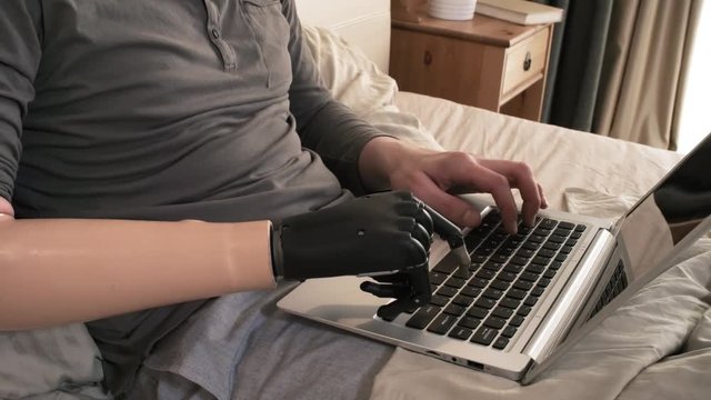 Close-up hands and midsection shot of Caucasian male amputee with myoelectric prosthetic forearm reclining in bed at home and working on laptop, typing with one finger of bionic wrist