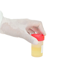 Hand holding urine bottom on white background.