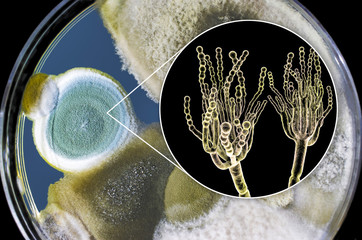 Penicillium mold fungi, 3D illustration and photo of colonies grown on nutrient medium