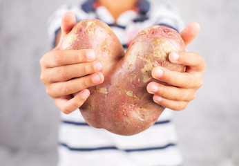 Boy holds ugly potato in the heart shape on a gray background. Funny, unnormal vegetable or food...