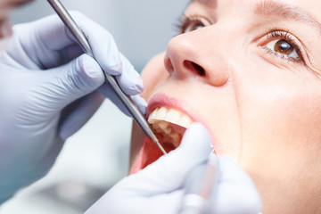 Examination oral cavity or treatment teeth, visiting dental office, blurred background